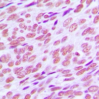 Anti-Cyclin E1 Antibody