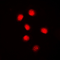 Anti-Cyclin E1 Antibody