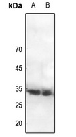 CDC2 (Phospho-Y15) Antibody