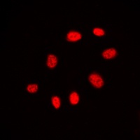 Anti-CDC25C Antibody