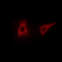 Anti-LI Cadherin Antibody