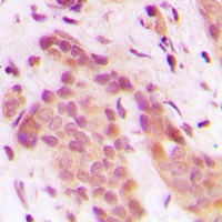 CDK8 Antibody