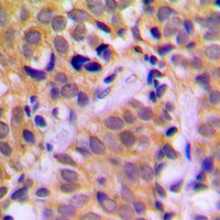 Anti-CHRNA1 Antibody