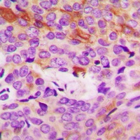 Anti-Collagen 4 alpha 5 Antibody