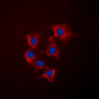 Anti-Collagen 4 alpha 5 Antibody