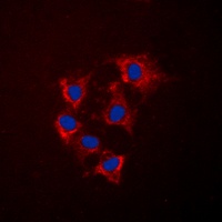 Collagen IV antibody