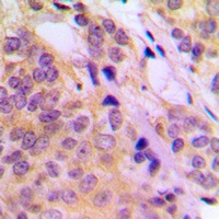 Anti-TPL2 (Phospho-T290) Antibody