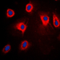 Anti-TPL2 (Phospho-T290) Antibody