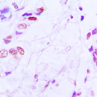 ATF2 Antibody