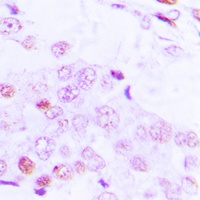ATF2 (Phospho-T69) Antibody