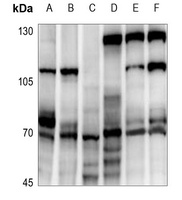 ATF2 Rabbit Polyclonal Antibody