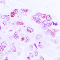 ATF2 Rabbit Polyclonal Antibody