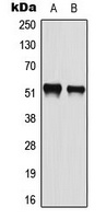 ATF2 (Phospho-S112) Antibody