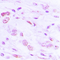 ATF2 (Phospho-S112) Antibody