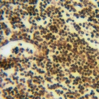 Anti-ATF6B Antibody