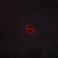 Anti-CRHR1 Antibody