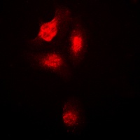 Anti-p38 (Phospho-T180) Antibody