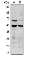 Anti-p38 (Phospho-T180) Antibody
