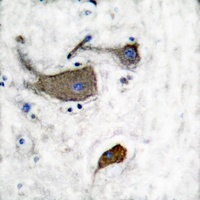 Anti-CD131 (Phospho-Y593) Antibody
