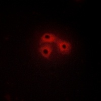 CSK Antibody