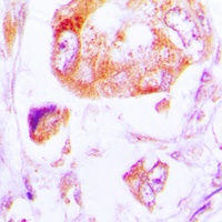 Anti-CK1 alpha Antibody