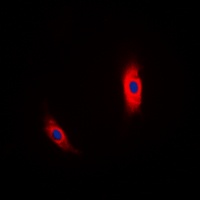 Anti-CK1 alpha Antibody