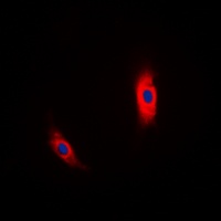 CSNK1A1 antibody