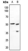 CstF-50 Rabbit Polyclonal Antibody