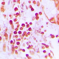 CstF-50 Rabbit Polyclonal Antibody