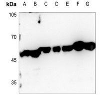 CTBP2 Antibody [KO/KD Validated]