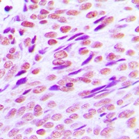 Anti-CTBP2 Antibody