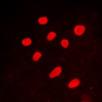 Anti-CTBP2 Antibody