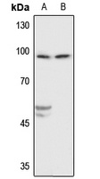 Beta-catenin Rabbit Polyclonal Antibody