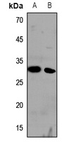 Cathepsin H Rabbit Polyclonal Antibody