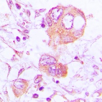 Cathepsin H Rabbit Polyclonal Antibody