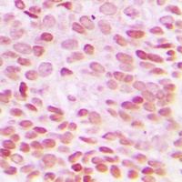 Anti-GADD153 Antibody