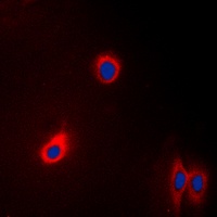 Anti-EEF2 Antibody