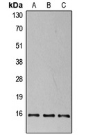 4EBP1 (Phospho-T37) Antibody