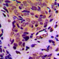 4EBP1 (Phospho-T37) Antibody