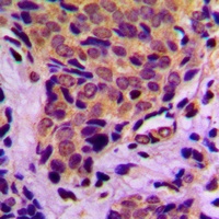 EIF4EBP1 antibody