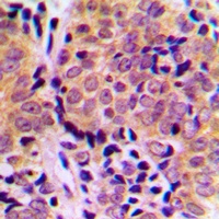 4EBP1 (Phospho-T46) Antibody