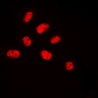Anti-NET (Phospho-S357) Antibody
