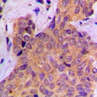 Cortactin (Phospho-Y421) Antibody