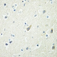 Anti-EPHB4 Antibody