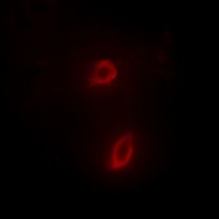 Anti-EPHB4 Antibody