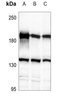 HER2 Rabbit Polyclonal Antibody