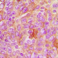 HER2 Rabbit Polyclonal Antibody