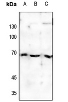 Estrogen Receptor alpha (Phospho-S118) Antibody
