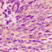 Estrogen Receptor alpha (Phospho-S118) Antibody