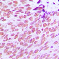 Anti-Estrogen Receptor alpha Antibody